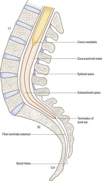 Lumbar Cistern