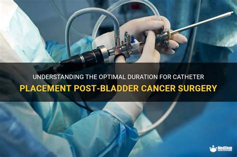 Understanding The Optimal Duration For Catheter Placement Post Bladder