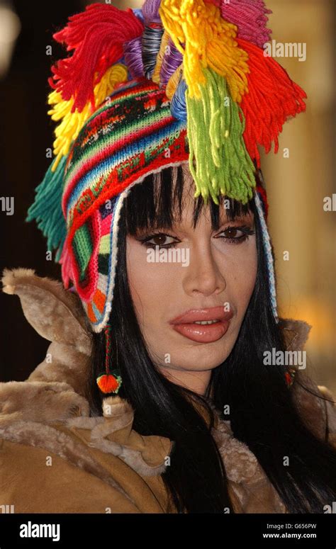 Pete Burns Lead Singer Of 80s Band Dead Or Alive During A Stock