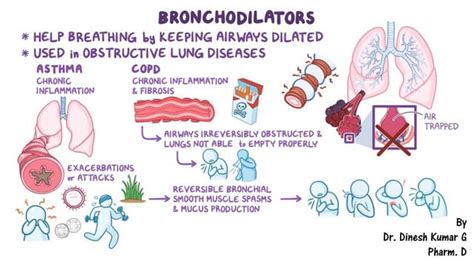 Bronchodilator | PPT