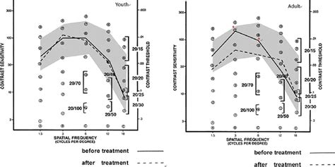 Effect of Orthokeratology Lens on Contrast Sensitivity Funct... : Eye ...