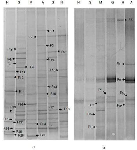 Dgge Profiles Of 16s Rrna Gene Fragments Amplified From Different Download Scientific Diagram