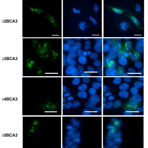 Immunolocalization Of Individual Exon Deleted Bca Variants In Hela