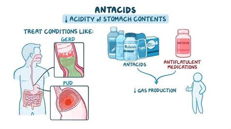 Antacids: Nursing pharmacology - Osmosis Video Library