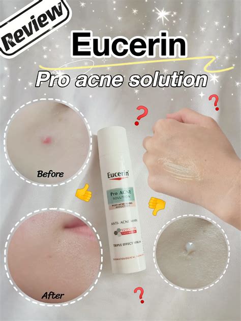 REVIEW EUCERIN Pro Acne Solution A I Matt Fluid Galeri Disiarkan