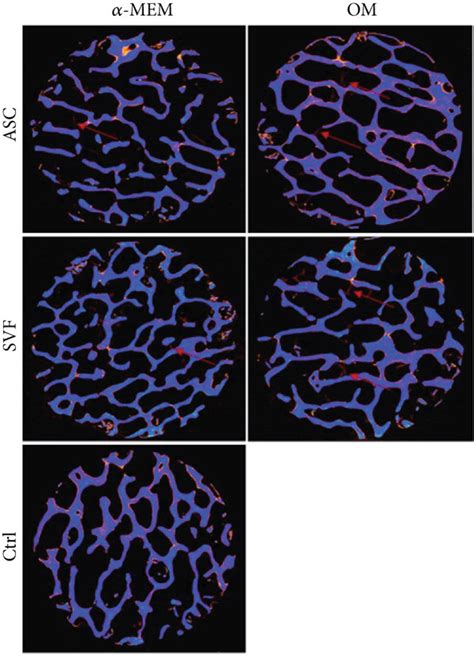 Analysis Of New Bone Formation By Micro Ct A Representative Images