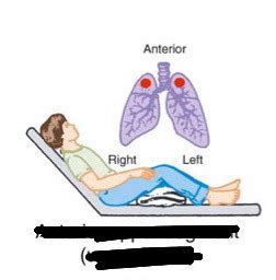 Postural Drainage Positions Flashcards Quizlet