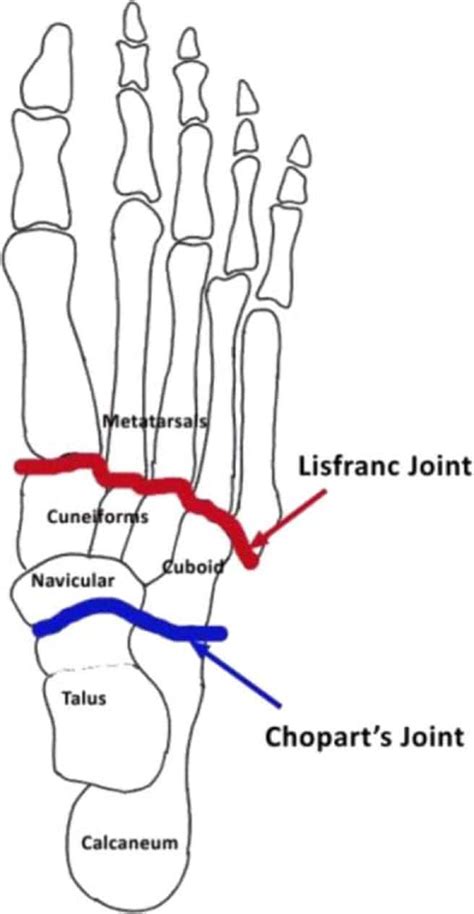 Lisfranc Injuries Of The Foot An Injury You Must Respect