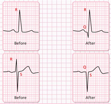 Cardio Rhythms Online