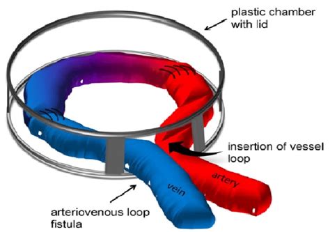 Venous Looping