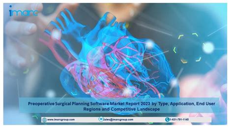 Preoperative Surgical Planning Software Market 2023 Worth Us