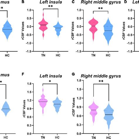 Comparison Of Regional Cerebral Blood Flow RCBF Values Between The