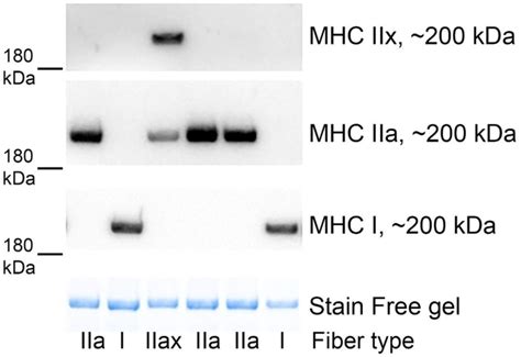 Representative Western Blotting Of Myosin Heavy Chain Mhc I Iia And