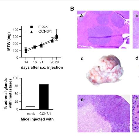 Ccn3 Full Length Overexpression Promotes Visceral Metastatic