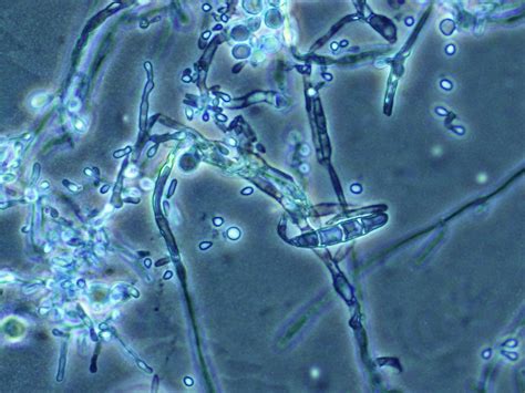 Macroconidia Of Ttonsurans Notes Report Cards Notebook