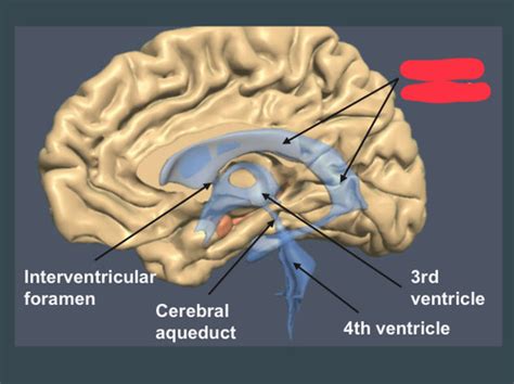 Bsc L Exam Brain Ventricles Image Flashcards Quizlet