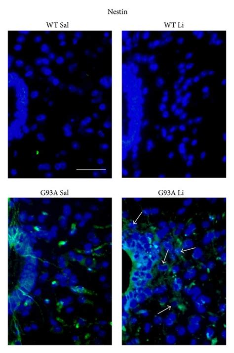 Nestin Immunostaining Within Lamina X Representative Pictures Are