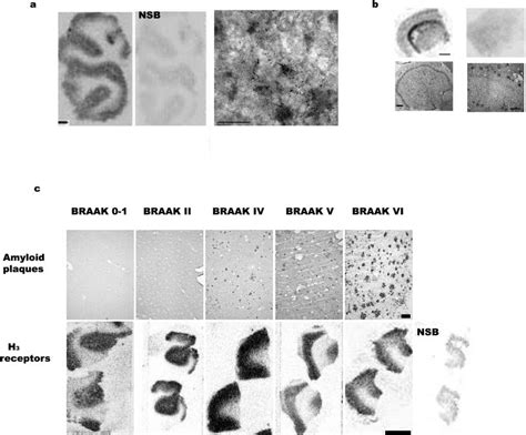 In Vitro Autoradiography Of 3 H GSK189254 Binding To Human Brain H 3