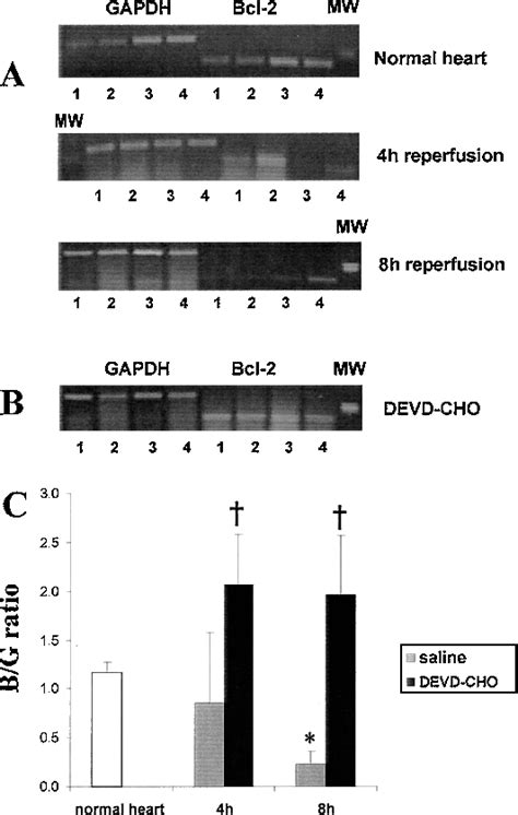 Figure 1 From Upregulation Of Bcl 2 Through Caspase 3 Inhibition