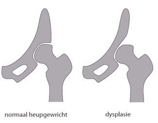 Heupdysplasie L Fysiotherapie L Fysio Jansen Deurne