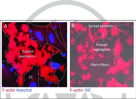 Platelet rich plasma rotation perfusions on TNFα treated monolayers of