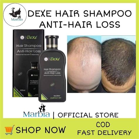 Effective Dexe Anti Hair Loss Shampoo With Advance Formula Ml Hair