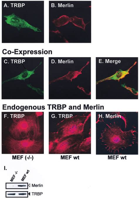 Subcellular Localizations Of Merlin And TRBP NIH3T3 Cells Were