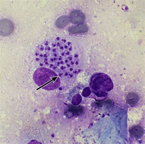 Mbb Cutaneous Leishmaniasis Flashcards Quizlet