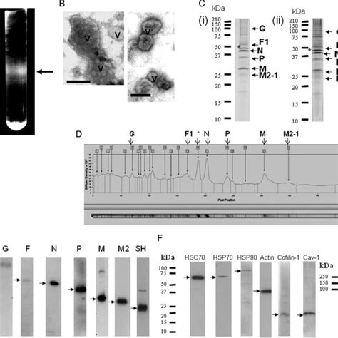 Purification Of Virus Particles By Sucrose Gradient Centrifugation A