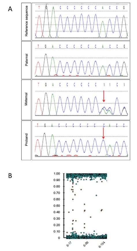 Genetic Analysis Of The Proband A Sanger Sequencing Electropherograms