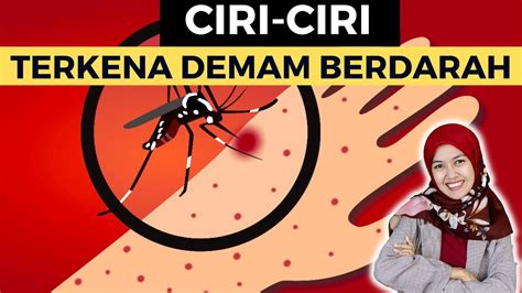 Apa Saja Tanda Dan Ciri Terkena Demam Berdarah Dbd Youtube