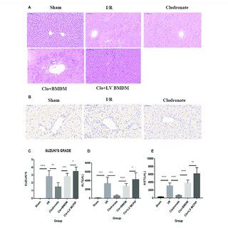 Mcpip Knockdown Aggravated Liver Ir Injury In C Bl Mice A