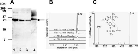 Detection By Mass Spectrometry Of 3 Nitrotyrosine In Hdl Isolated From