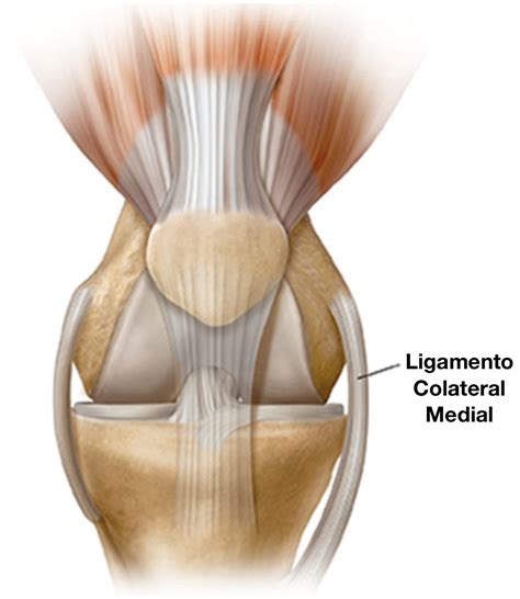 Lesão Do Ligamento Colateral Medial Do Joelho Entendendo E Tratando Dr Marcos Mestriner