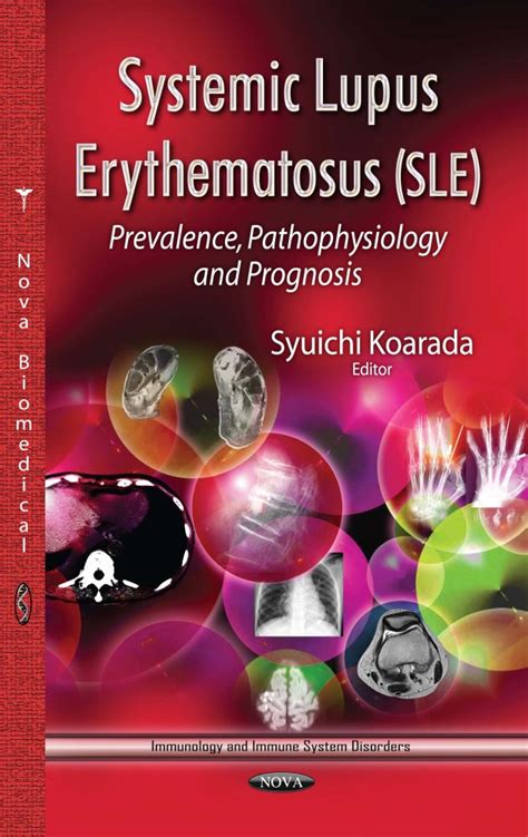 Systemic Lupus Erythematosus Pathophysiology The Role Of Cellular