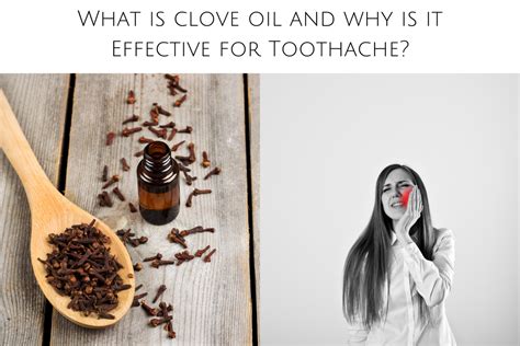 What Is Clove Oil And Why Is It Effective For Toothache Kiwla