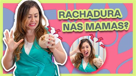 Bico Do Peito Rachado Como Curar R Pido Rachadura Nas Mamas Youtube