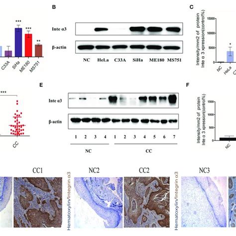 Integrin α3 Promotes The Migration And Invasion But Not