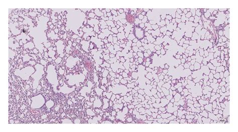 Lung Function And Pathological Sections A B Lung Function Changes