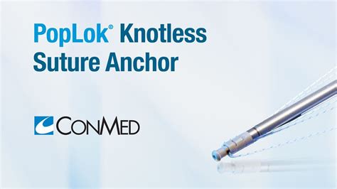 Poplok® Knotless Suture Anchor Conmed Product Video Youtube