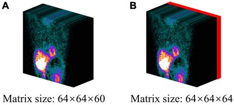 Frontiers Fast Myocardial Perfusion Spect Denoising Using An