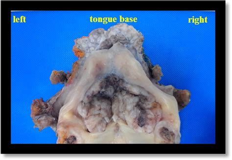 Operative Techniques In Otolaryngology Head And Neck Surgery