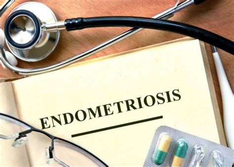 Endometriosis Treatment in UAE | Ferti Clinic