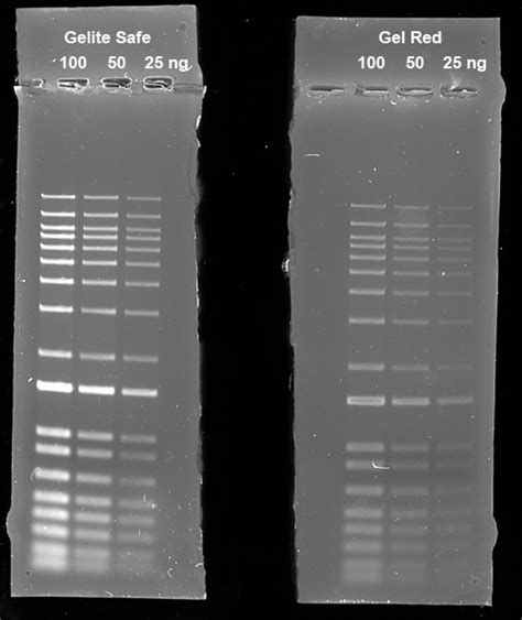 Electrophoresis Gel Selection Aat Bioquest