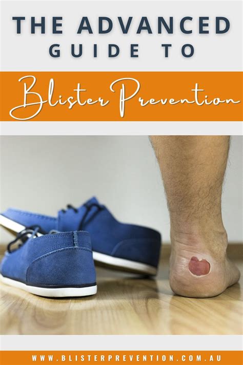 The advanced guide to blister prevention 2013 – Artofit