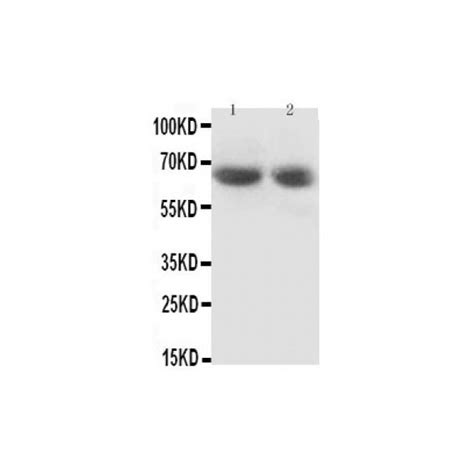 Gad65 Antibody Novatein Biosciences