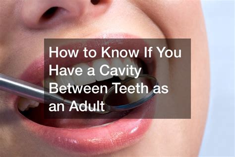 How To Know If You Have A Cavity Between Teeth As An Adult