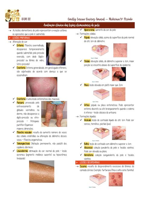 Lesões Elementares Em Dermatologia Librain