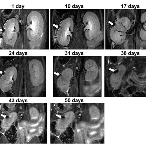 In Vivo Magnetic Resonance MR Images Of A MnMEIO Ex4 Labeled NPCCs