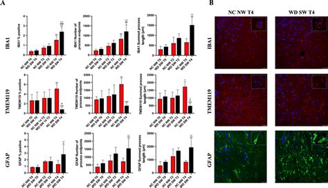 Immunofluorescence Staining For Iba And Tmem In Microglia And For